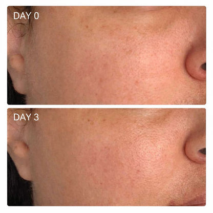 Miyora Bio-Collagen Recovery Mask™